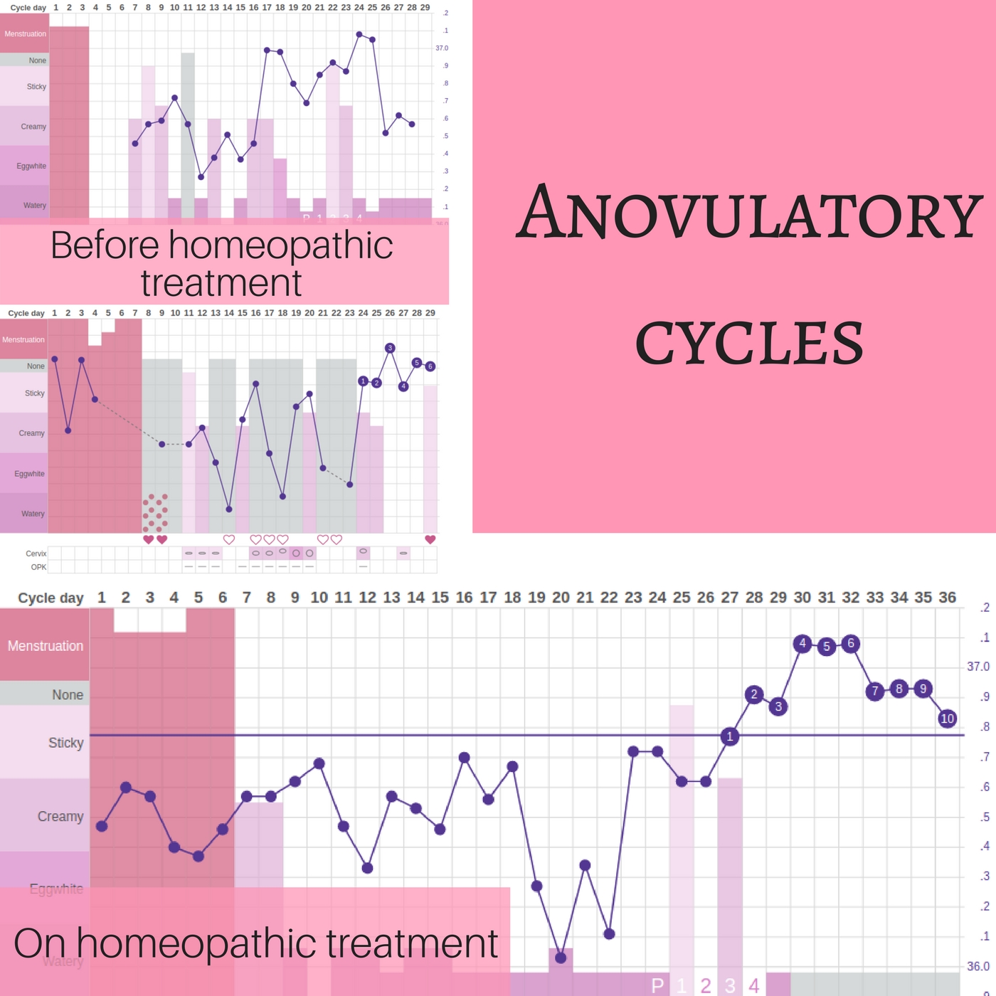 Anovulatory cycles